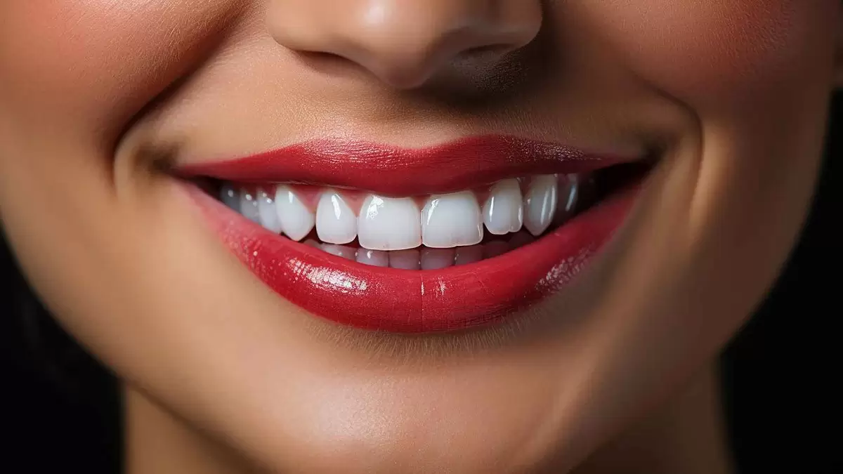 أفضل طبيب أسنان لابتسامة هوليوود في اسطنبول