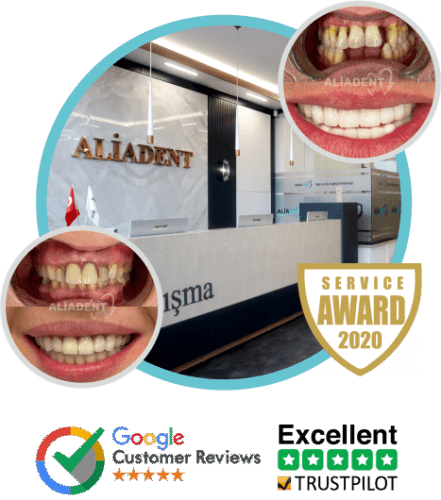 dental implant turkey in istanbul min