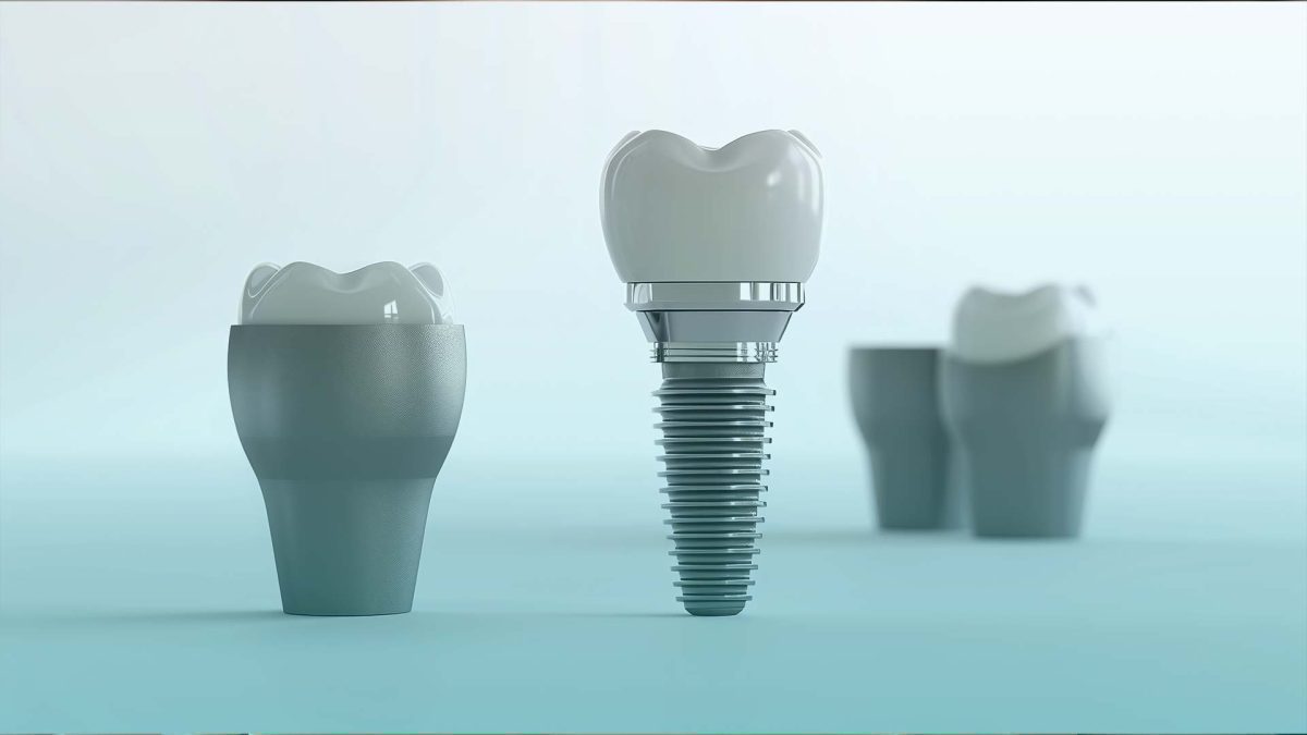 A smiling patient receiving All-on-Four implants in Istanbul, Turkey, showcasing modern dentistry.