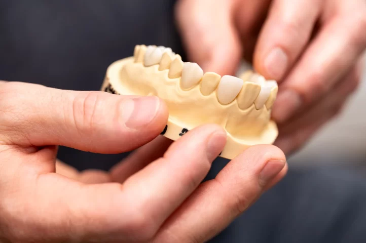 Learn about crown and bridge prostheses options including metal, ceramic, and zirconium for durable and aesthetically pleasing dental restorations.