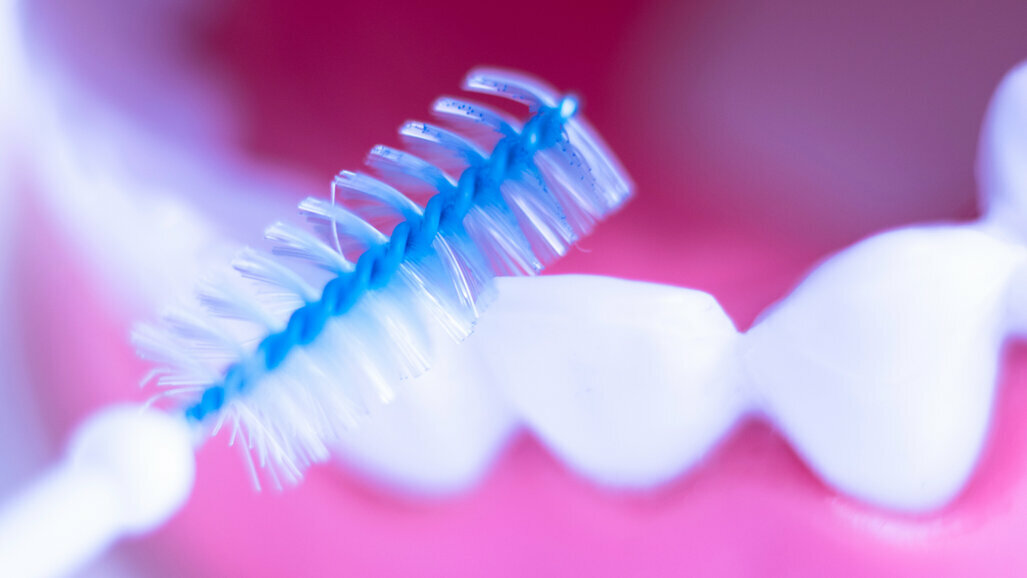 Interdental Brushes - What Are The Benefits - Aliadent