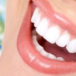 Explore the applications of Lamina in CAD/CAM technology, revolutionizing dental prosthetics for precise and efficient results.