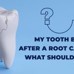 Tooth broke after a root canal.