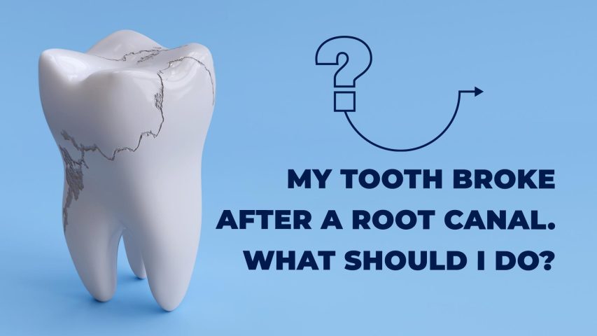 Tooth broke after a root canal.