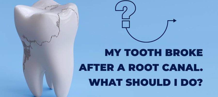 Tooth broke after a root canal.