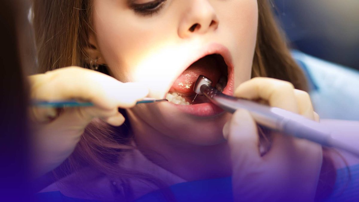Root canal treatment in Istanbul.