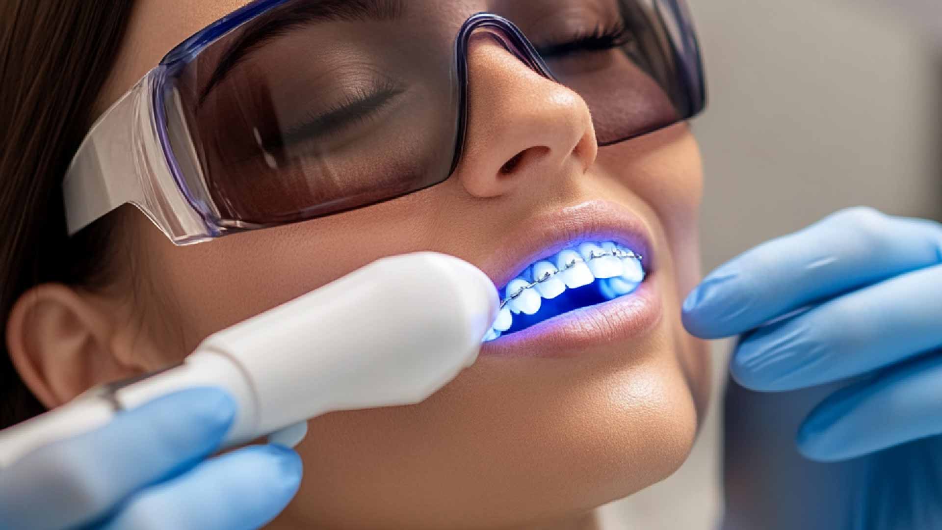 Have you ever hear about teeth wnitening Istanbul? Find more informations with cosmetic dentistry in Turkey.