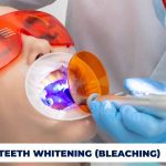 Brighten your smile with professional services of teeth whitening Turkey, known for exceptional dental care and results.