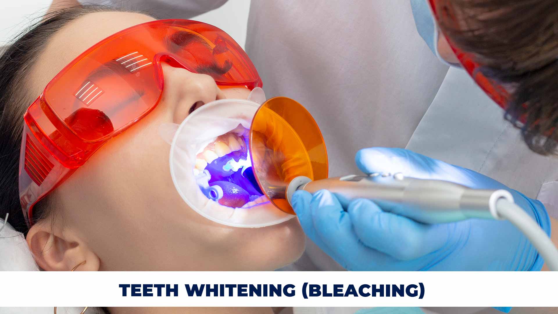 Brighten your smile with professional services of teeth whitening Turkey, known for exceptional dental care and results.