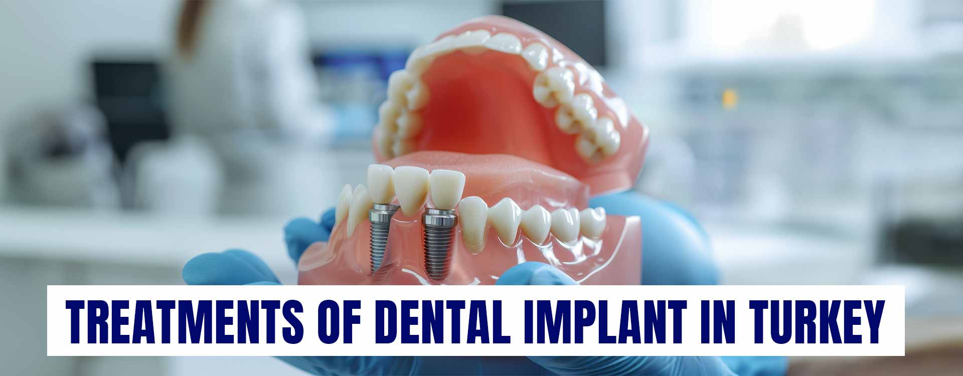 Explore advanced treatments of dental implant in Turkey, providing effective solutions for tooth replacement and restoring your smile with expert care.