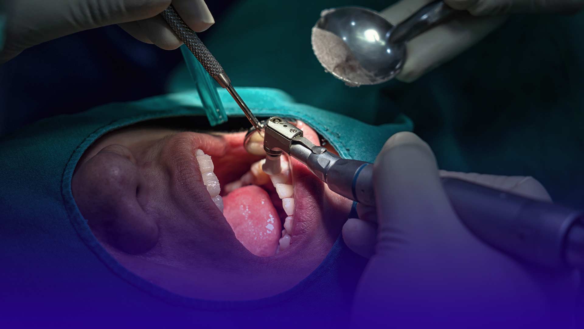 Why choose Istanbul for dental treatments.