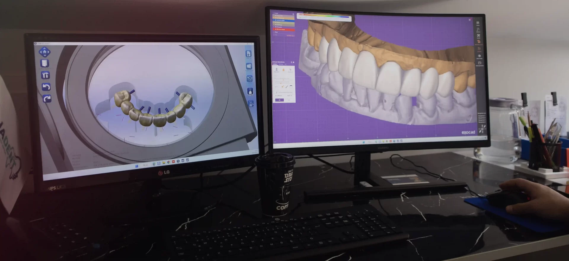 Explore aesthetic dentistry in Istanbul Levent, Turkey.
