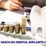 How much do dental implants cost, providing insights into pricing for tooth replacement solutions.