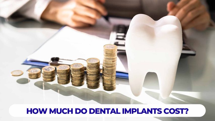 How much do dental implants cost, providing insights into pricing for tooth replacement solutions.