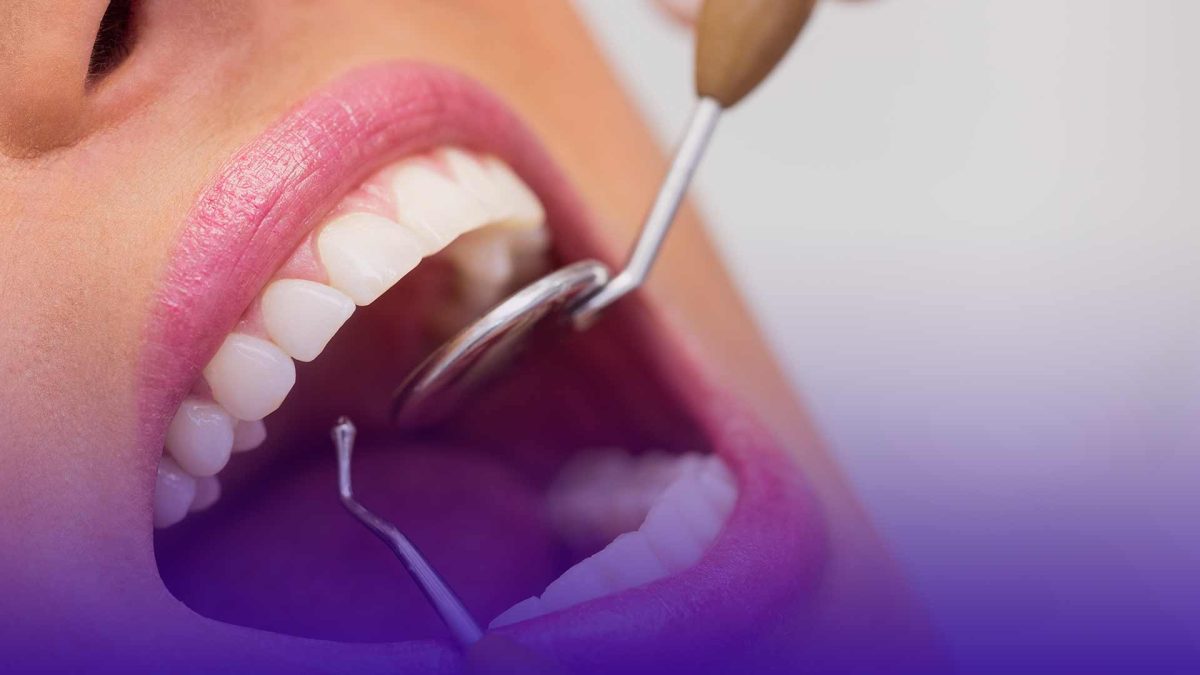 long term care after a tooth knockout