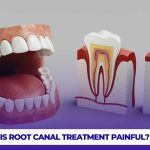 Root canal treatment is generally not painful, as it is performed under local anesthesia to ensure comfort during the procedure.