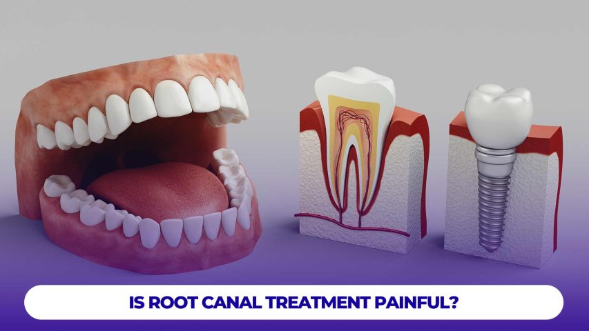 Root canal treatment is generally not painful, as it is performed under local anesthesia to ensure comfort during the procedure.