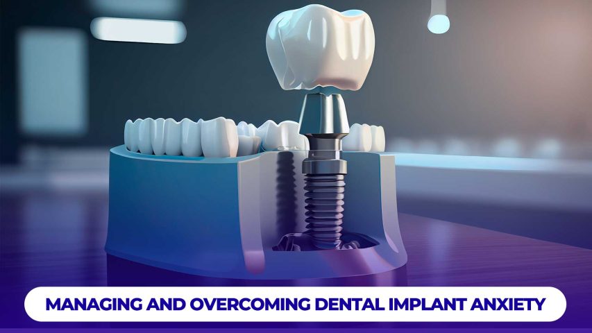 Managing and overcoming dental implant anxiety involves relaxation techniques, clear communication with your dentist, and proper preparation.