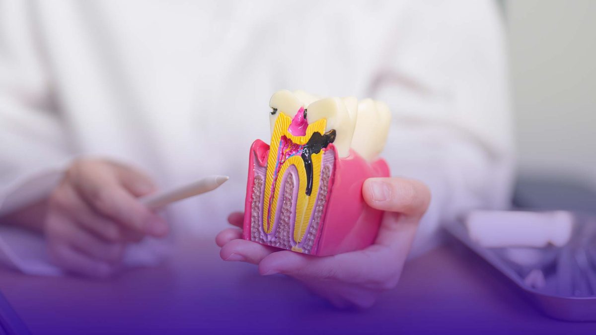 root canal treatment in istanbul affordable and high quality