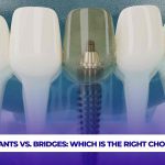 Dental implant vs dental bridges: Which is the right choice?