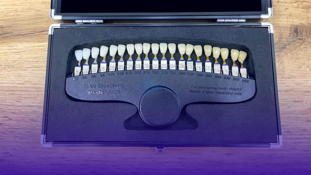 which crown is right for you