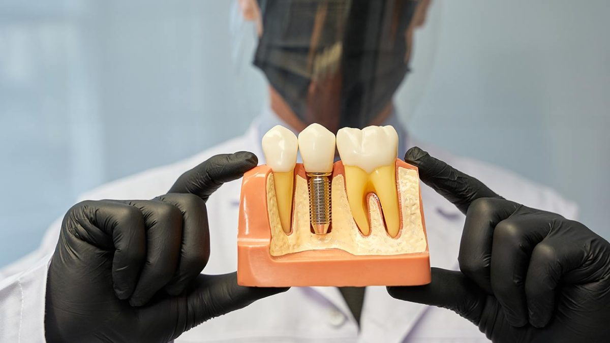tooth extraction and simultaneous dental implant procedures ic2