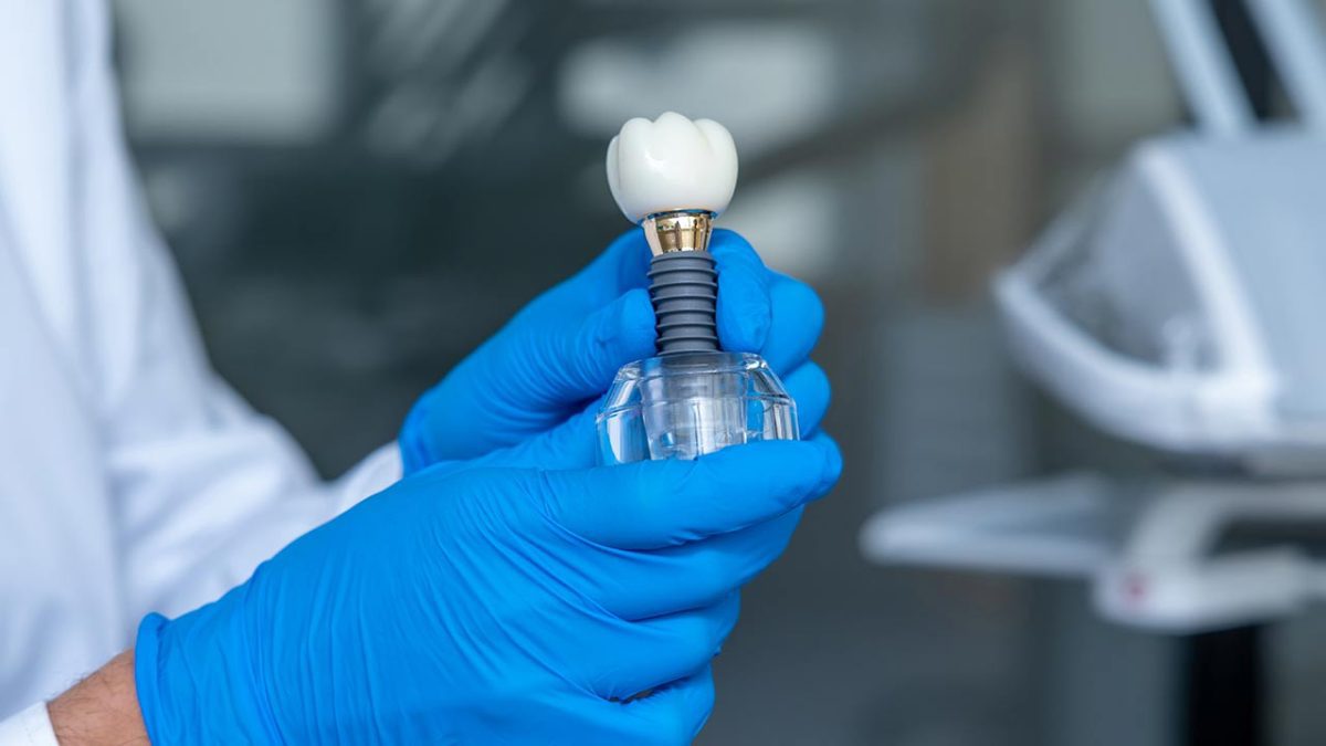 tooth extraction and simultaneous dental implant procedures ic3