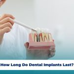 Dental implants restore your smile and improve chewing with long-lasting, natural-looking results.