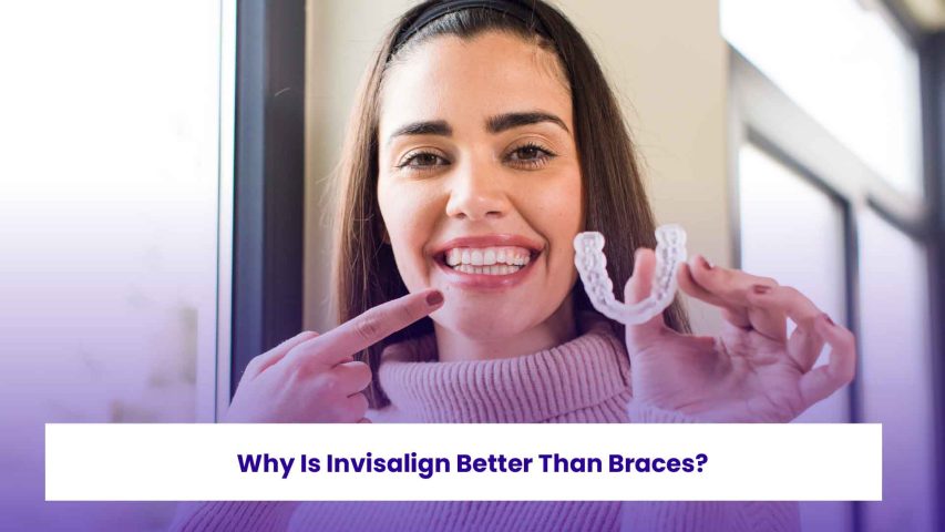 Clear aligners help straighten your teeth comfortably and invisibly for a hassle-free smile.