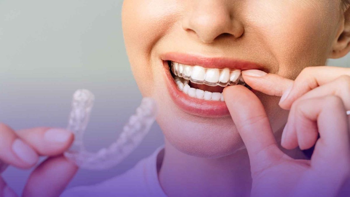 Why Is Invisalign Better Than Braces? 7 Get a confident smile with traditional braces — effective and reliable orthodontic treatment!