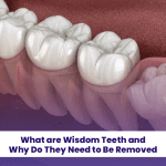 Learn what are wisdom teeth and why do they need to be removed.