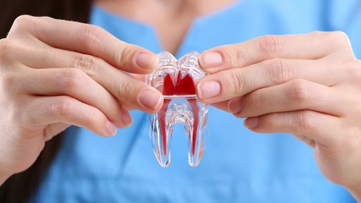Discover root canal treatment steps with Aliadent.