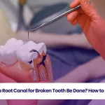 Explore the details of root canal for broken tooth.