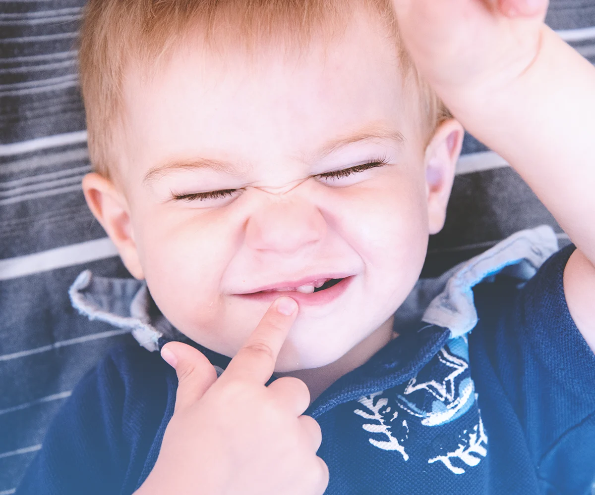 does breast milk cause tooth decay