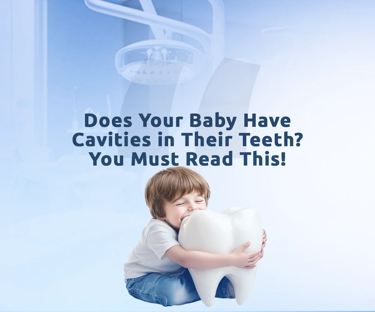 Early childhood caries is shown through visible tooth decay affecting young children’s teeth.