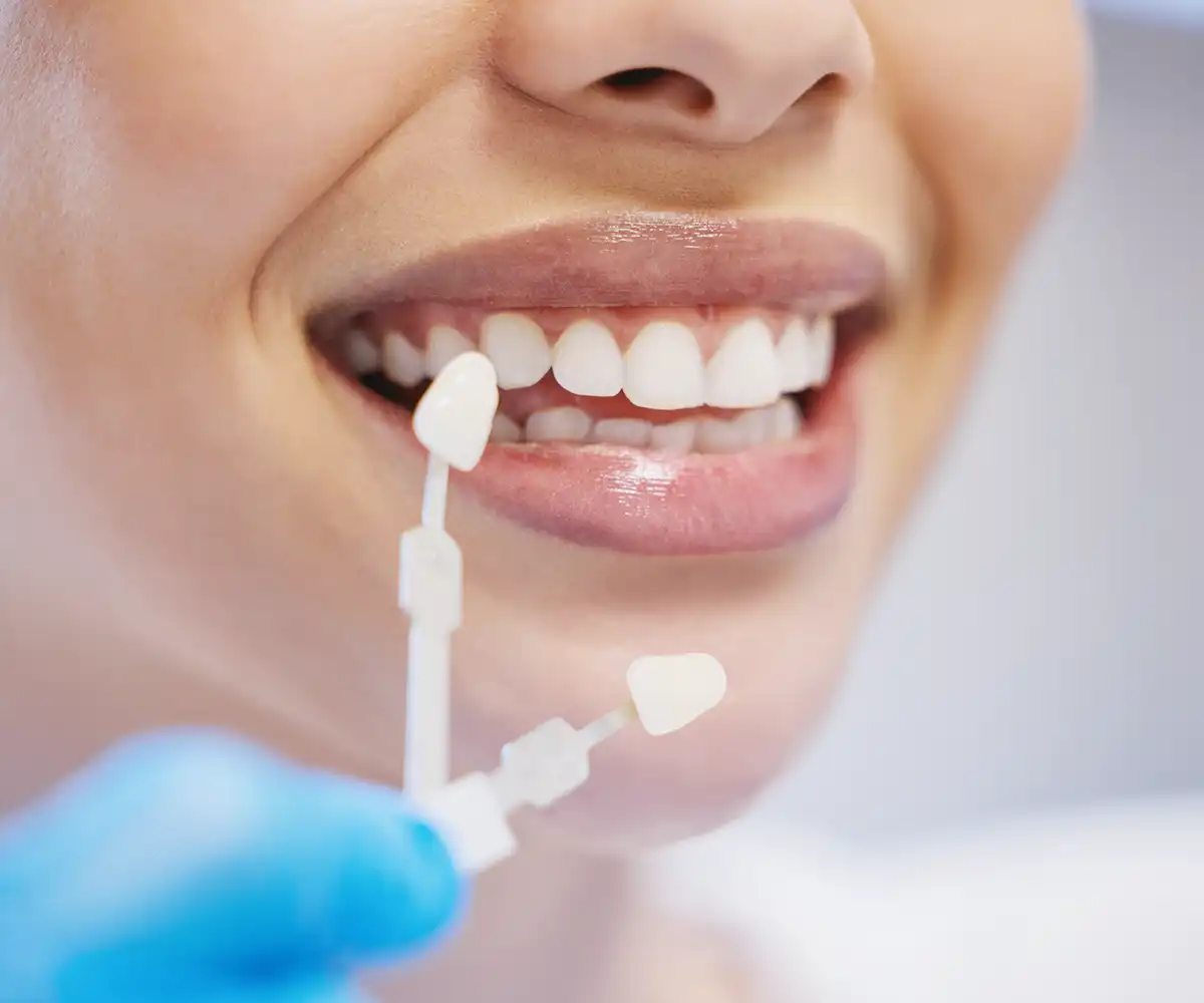 dental crowns smell bad