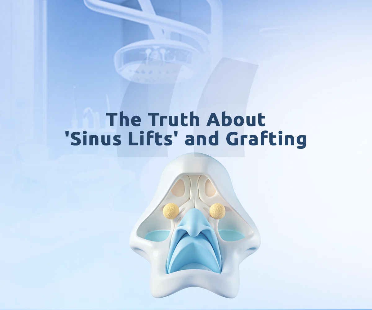 Sinus lift for dental implants at Aliadent supports stable and long lasting results.