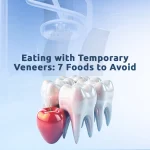 What to eat with temporary veneers includes soft foods to protect your new smile.