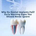 An image about dental implant failure showing signs and steps to avoid complications.