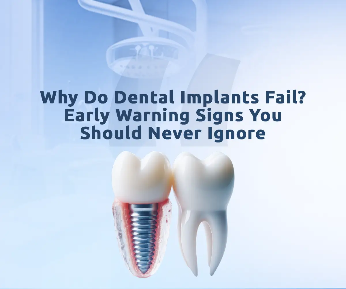 An image about dental implant failure showing signs and steps to avoid complications.