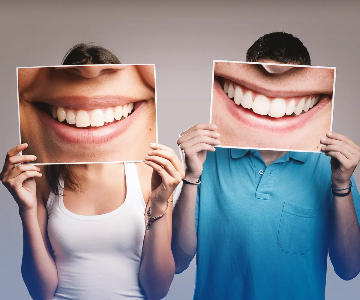 choosing composite bonding vs veneers