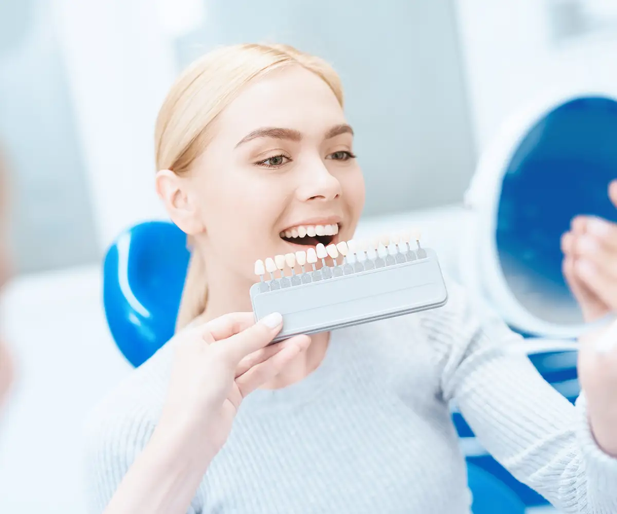 natural looking veneers