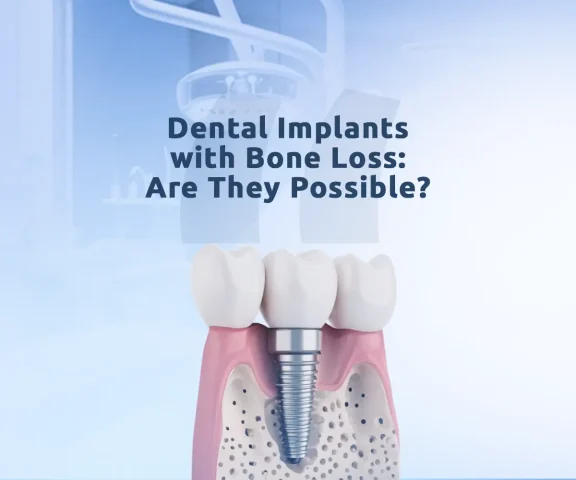 An image about dental implants with bone loss and treatment options for bone restoration.