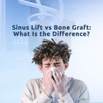 An image explaining sinus lift vs bone graft differences in dental implant planning process.
