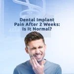 Dental implant pain is usually mild and temporary after surgical placement and healing process.
