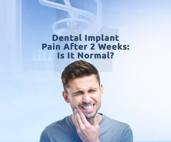 Dental implant pain is usually mild and temporary after surgical placement and healing process.
