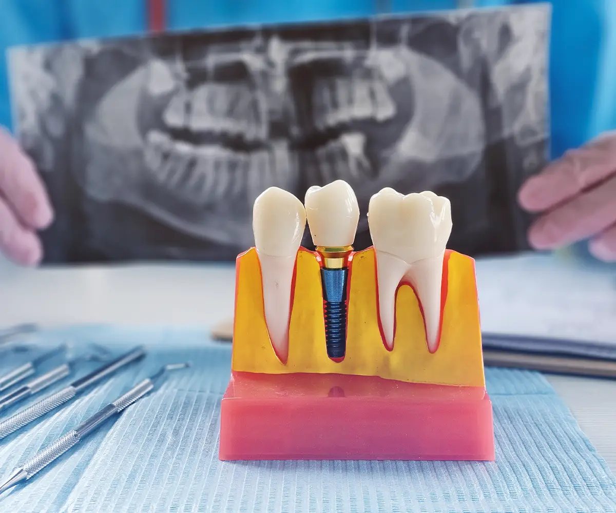 jawbone loss happens for many reasons