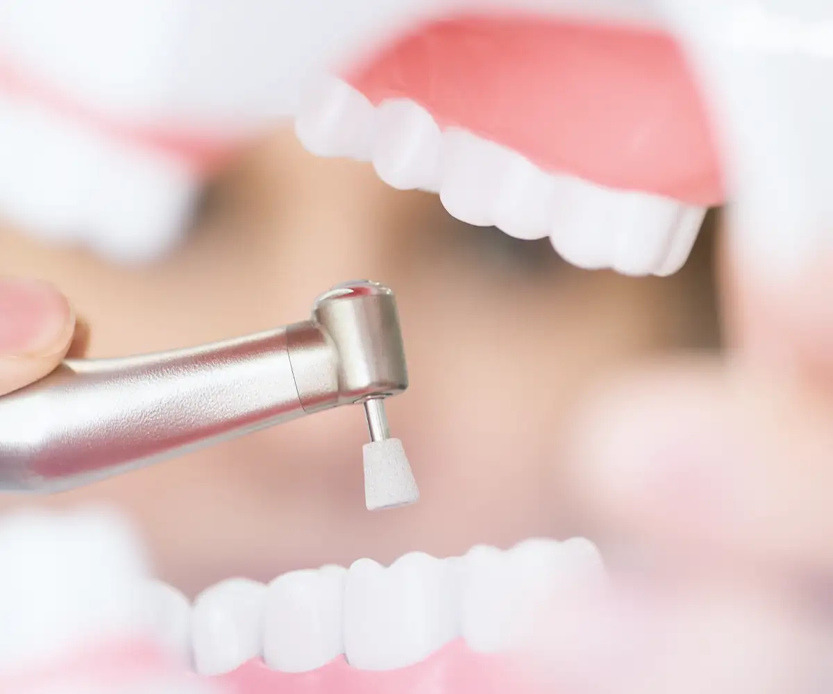Why New Spaces Appear After a Deep Clean 7 root canal treatment endodontics istanbul