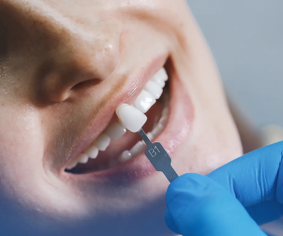 Flying Home After Dental Implants: How Soon Is It Safe? 6 flying after dental implants safe travel timeline and recovery guide
