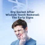 Dry Socket After Wisdom Tooth Removal: The Early Signs 3 dry socket after wisdom tooth removal symptoms